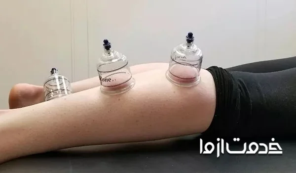 هزینه حجامت 1404